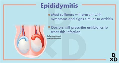 Epididymitis Without Antibiotics