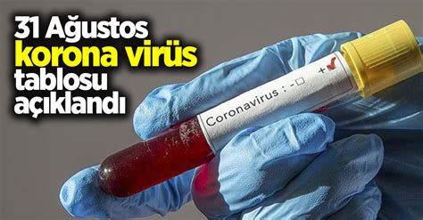 Jun 21, 2021 · korona tablosu! 31 Ağustos korona virüs tablosu açıklandı