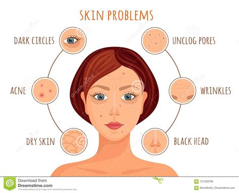 Types Of Skin Problems Types Of Skin Conditions Pictures Photos