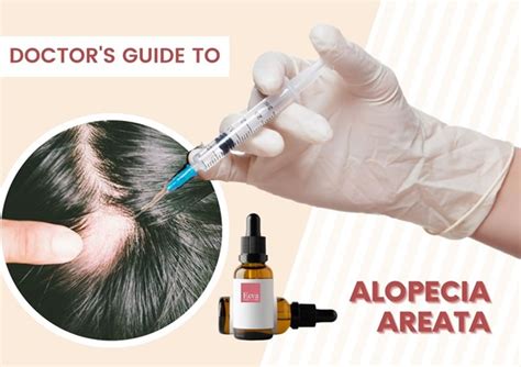 Guide To Alopecia Areata Treatment Eeva Medical Clinic