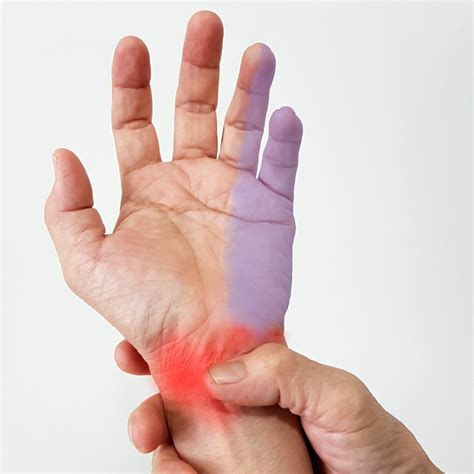 Discover over 265 of our best selection of 1 on aliexpress.com. Spinewise Health & Performance | The pins and needles in ...