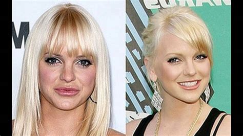 Anna Faris Plastic Surgery Before And After Youtube