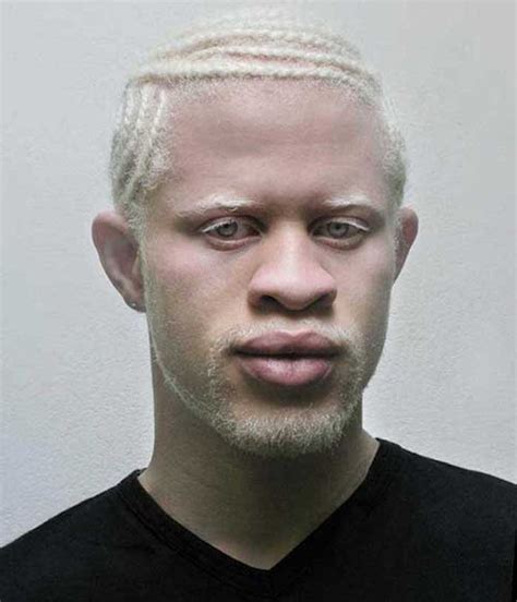 Épinglé sur albinos man