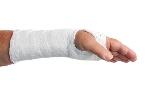 Broken Hand Bones Pictures Broken Hand Symptoms And Causes