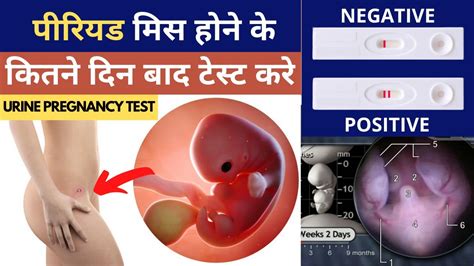 पीरियड मिस होने के कितने दिन बाद टेस्ट करे Pregnancy Test Kab Kare Youtube Saheli Youtube