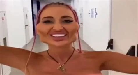 Womans Botched Plastic Surgery Makes Her Face Look Animated