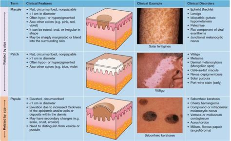 Introduction To Dermatology The Basics Describing Skin Lesions