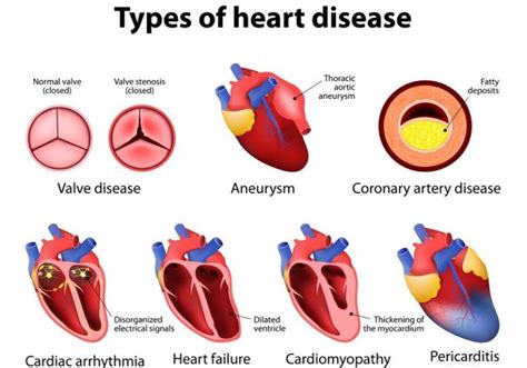 Heart Disease Weightloss And Wellness Center