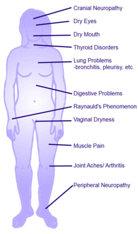 7 Symptoms Of Sjögrens Syndrome Youmemindbody