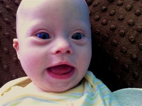 Down Syndrome Facts Physical Therapy Video Baby With Down Syndrome