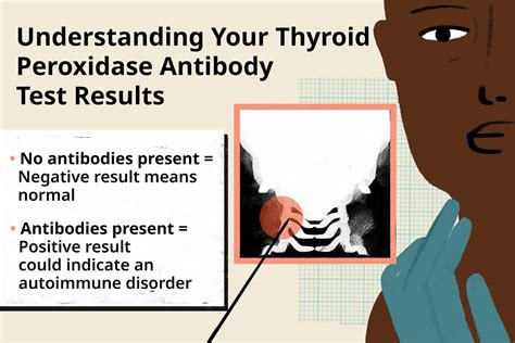 Thyroid Peroxidase Antibody Test Purpose Procedure Results