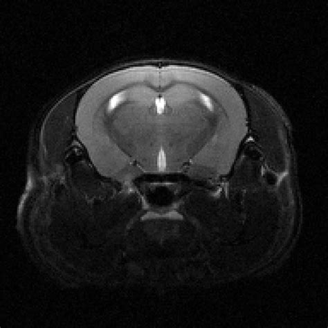 Mouse Brain Anatomical Mri 2d Camri