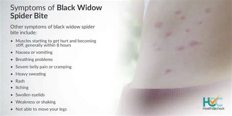 What Is Black Widow Spider Bite Hoc