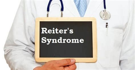 A Short Note On Reiter S Syndrome