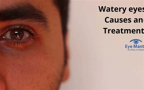 Watery Eyes Causes And Treatments Eyemantra Foundation