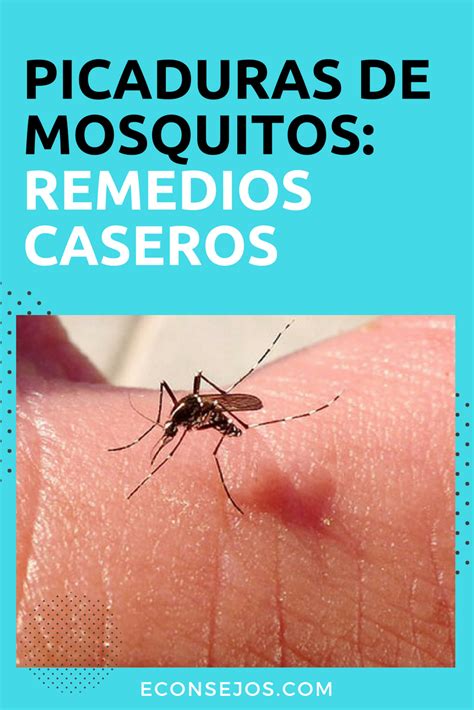 Alivia Las Picaduras De Mosquitos Con Estos Remedios Caseros Ideal