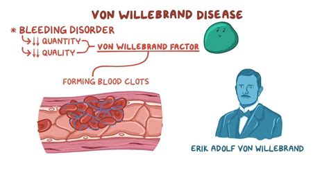 Von Willebrand Disease Osmosis