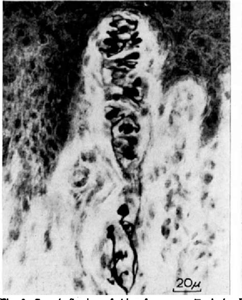 Figure From The Digital Nerves And The Nerve Endings In Progressive