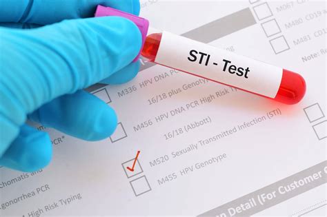 New Cdc Guidelines Endorse Opt Out Screening For 2 Most Common Stis