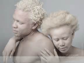 See Why This Albino Photo Shoot In Cameroon Has Gone Viral By Tribe Africa Media The Hotjem