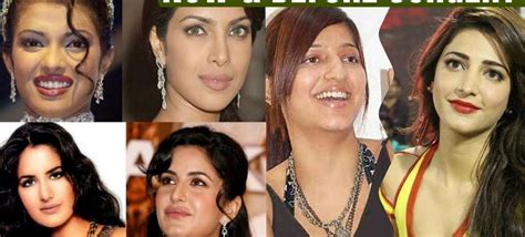 Bollywood Actresses With Plastic Surgery Bollywood Plastic Surgery Before And After Gambaran