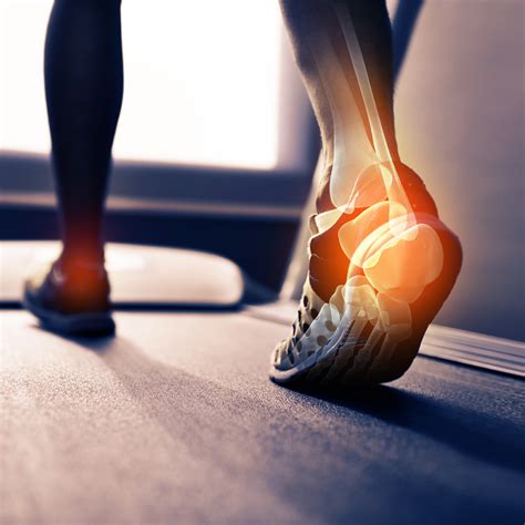Neuropathy Of The Foot Peripheral Neuropathy Lancaster Orthopedic Group Lancaster County