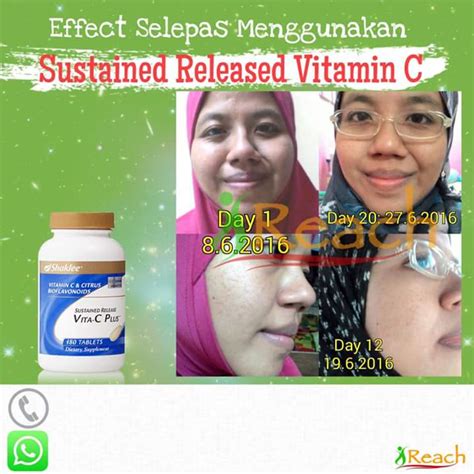 Ya, vitamin c tak hanya bisa bikin anda kebal dari serangan penyakit infeksi, tapi selain vitamin, ada juga berbagai mineral yang baik untuk menjaga kesehatan kulit anda. VITAMIN C UNTUK KULIT PUTIH GEBU YANG SELAMAT DAN BERKESAN ...