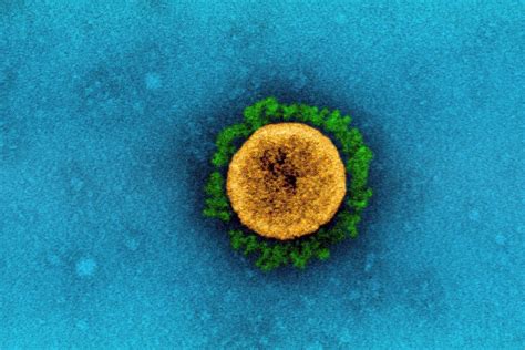 According to the who bulletin, this variant was first detected in peru in august 2020 and since then, it has been reported in 29 nations worldwide, mainly in latin america, including argentina and chile. Lambda variant of COVID-19 not reported in India so far ...