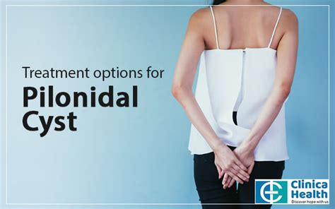 Treatment Options For Pilonidal Cyst Surgeon In Kolkata Describes