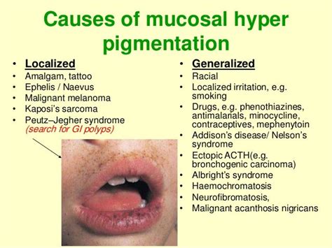 Oral Manifestations Of Systemic Diseases