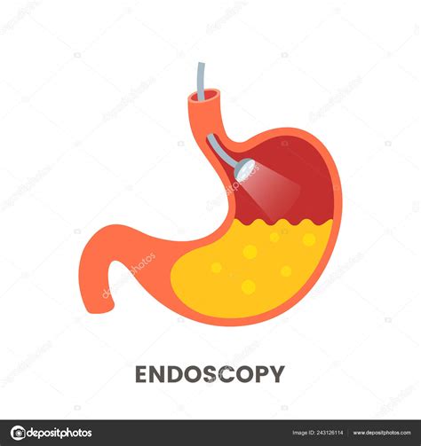 Stomach Endoscopy Flat Cartoon Endoscope Stomach Esophagus Gastroscopy