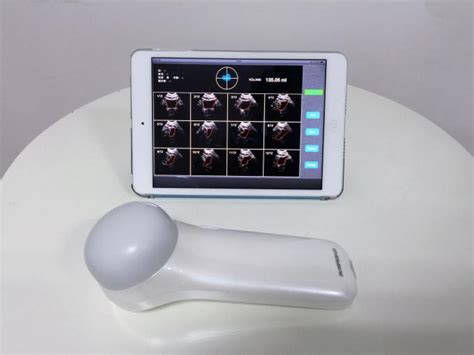 Les éléments inclus peuvent être modifiés et leur apparence peut varier. Portable waterproof 4D wireless bladder scanner bladder shape and size