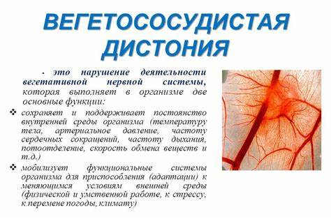 Обострение ВСД: симптомы, лечение, профилактика Картинка - Обострение ВСД: симптомы, лечение, профилактика