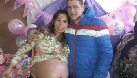 entró embarazada de gemelas al hospital y le dieron un solo bebé