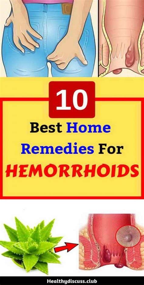Natural Ways To Get Rid Of Hemorrhoids Try This Home Remedies Home