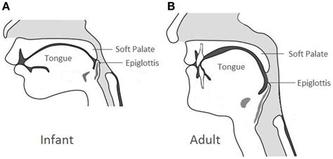 Anatomical Comparison Between The Infant Larynx And The Adult Larynx
