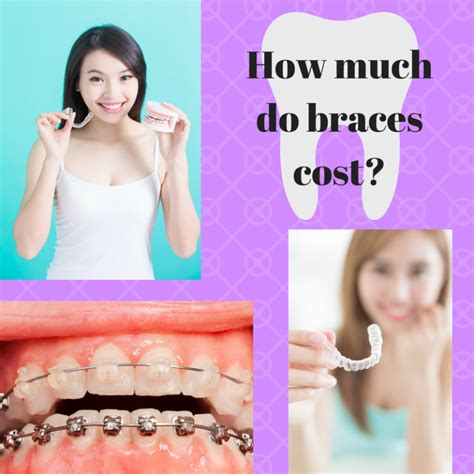 How Much Do Braces Cost — Mashouf Orthodontics
