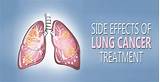 Pictures of Side Effects From Lung Cancer