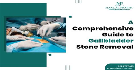 A Complete Guide To Gallbladder Stone Removalgallstone Treatment