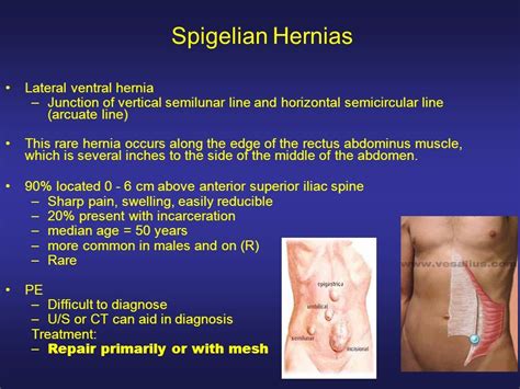 Understanding Abdominal Hernia In Males A Visual Guide Universe Rant