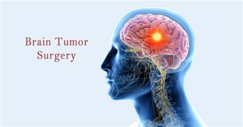 Boston Brain And Spine Care Best Neurosurgeon In Chennai