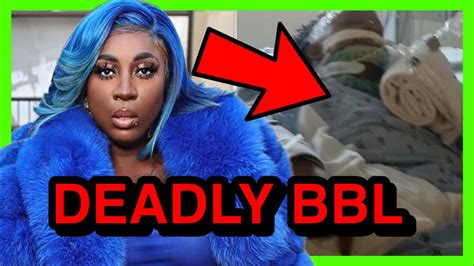 Omg Jamaican Artist Spice Is In A Bad Coma After Getting A Bbl In Dr Youtube
