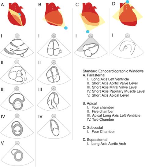 Ummd Echocardiogram