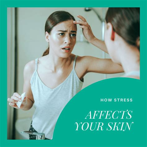 How Stress Affects Your Skin Annapolis And Severna Park Md