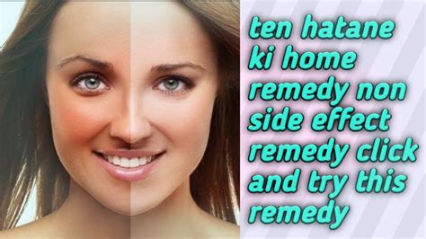 Tan Removing Best Home Remedy The Natural Beauty Youtube