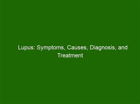 Lupus Symptoms Causes Diagnosis And Treatment Health And Beauty