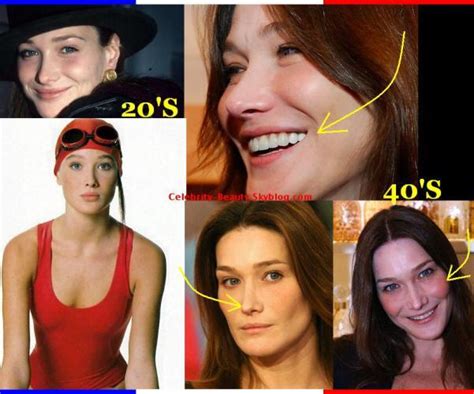 Carla bruni débarque sur instagram et publie (déjà) une photo d'elle jeune topless. Carla Bruni: The Case of Overdone Plastic Surgery - Paperblog