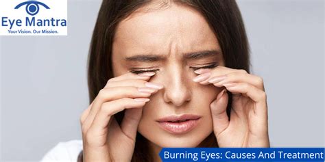 Burning Eyes Causes Treatment And Home Remedies