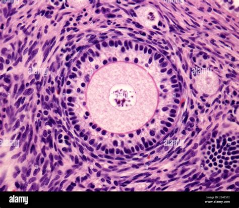 Light Microscope Micrograph Of An Ovary Primary Follicle With A Big Round Ovocyte Surrounded By