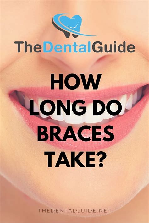 How Long Do Braces Take The Dental Guide
